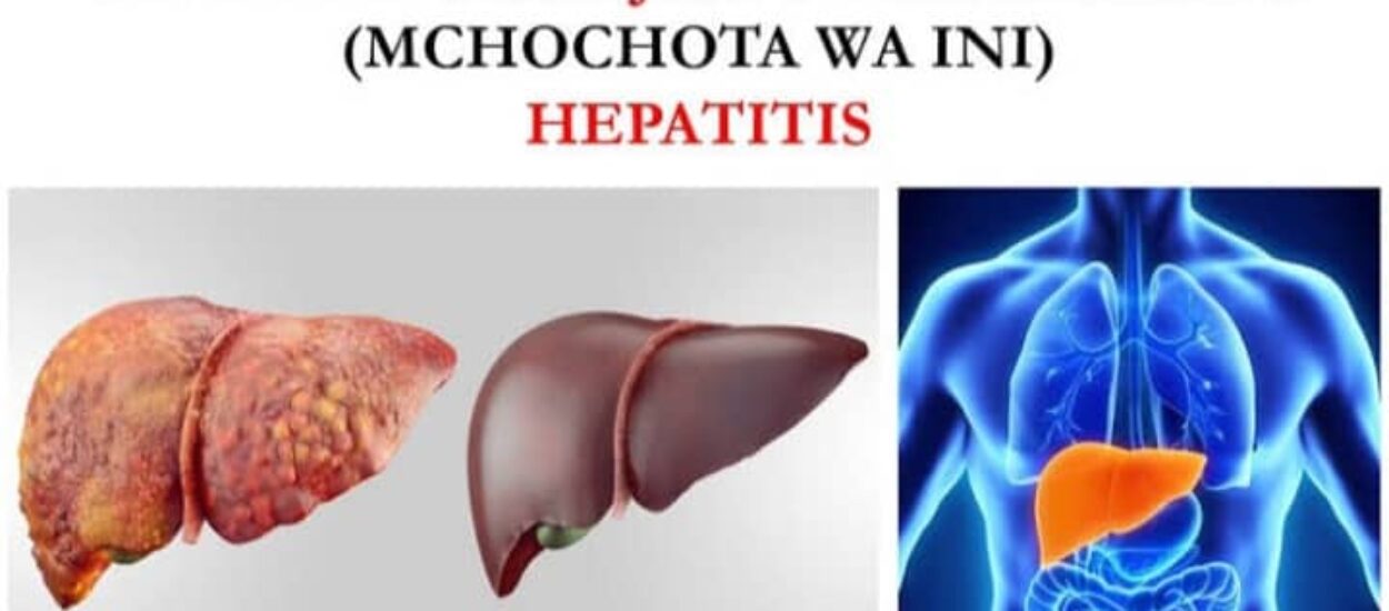 MACHINGA